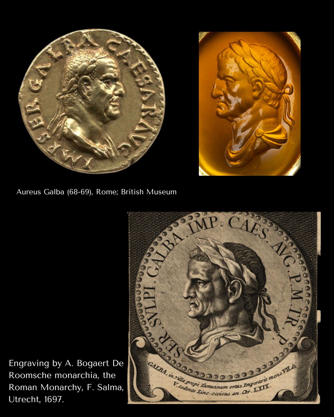 A gold ring set with a 18th century carnelian intaglio. Bust of Galba (reign 68-69 A.D.)